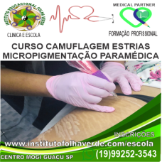 Curso Micropigmentação Camuflagem de estrias 