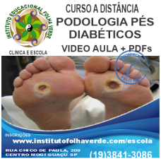 Curso Atendimento Na Podologia a Diabéticos e Podogeriatria EAD